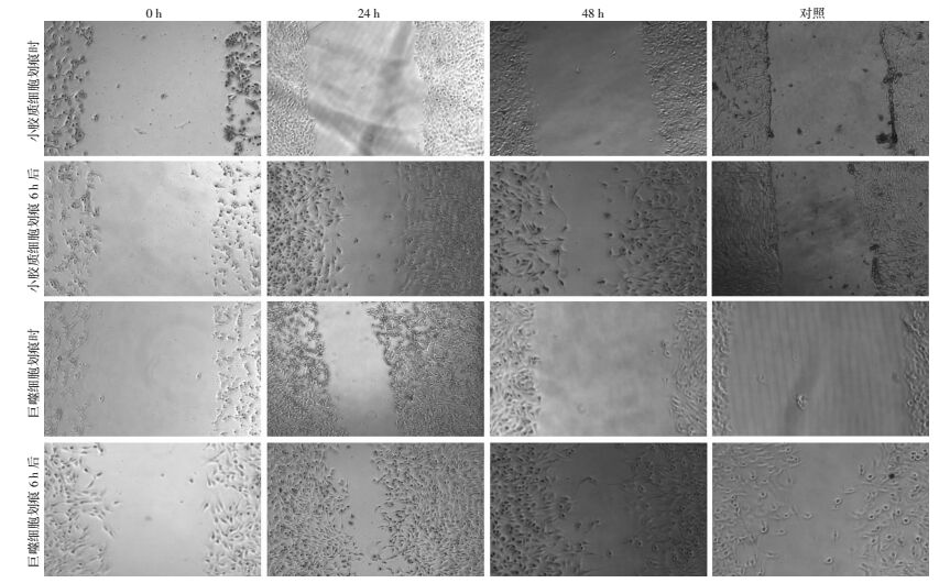 大鼠小胶质细胞及巨噬细胞对胶质瘤C6细胞株迁移能力的影响