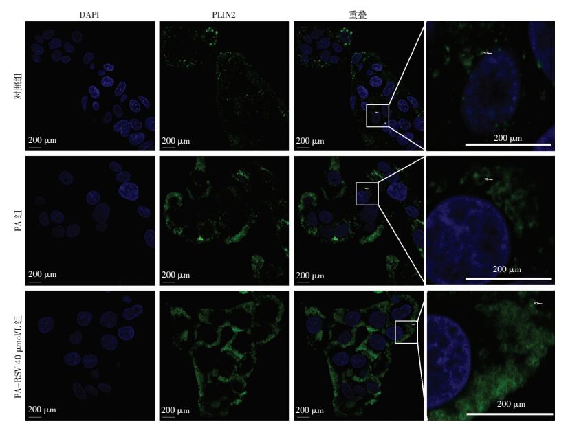 PKA-PLIN2通路促进HepG2细胞脂滴脂解